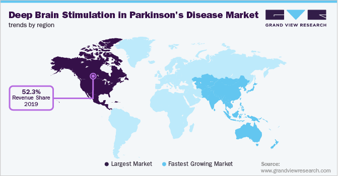Deep Brain Stimulation in Parkinson's Disease Market Trends by Region 脑深部电刺激在帕金森病由区域市场趋势