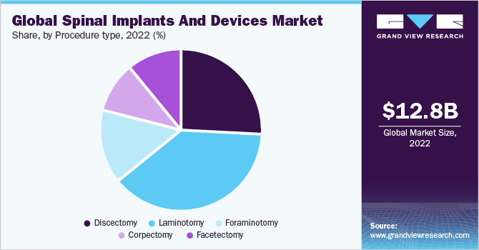 Global spinal implants & devices market share, by procedure type, 2021 (%) 2021年全球脊椎植入物和器械市场份额,按程序类型分列(%)